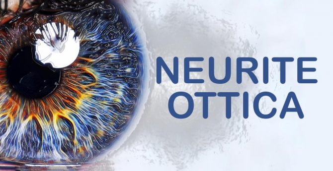 Neurite Ottica Sintomi E Cause Ability Channel