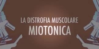 Distrofia muscolare miotonica