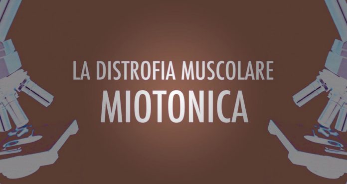 Distrofia muscolare miotonica