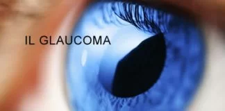 glaucoma