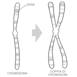 Sindrome di Noonan