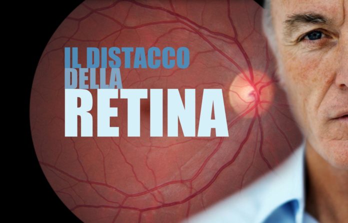 desprendimiento de retina sintomas y signos