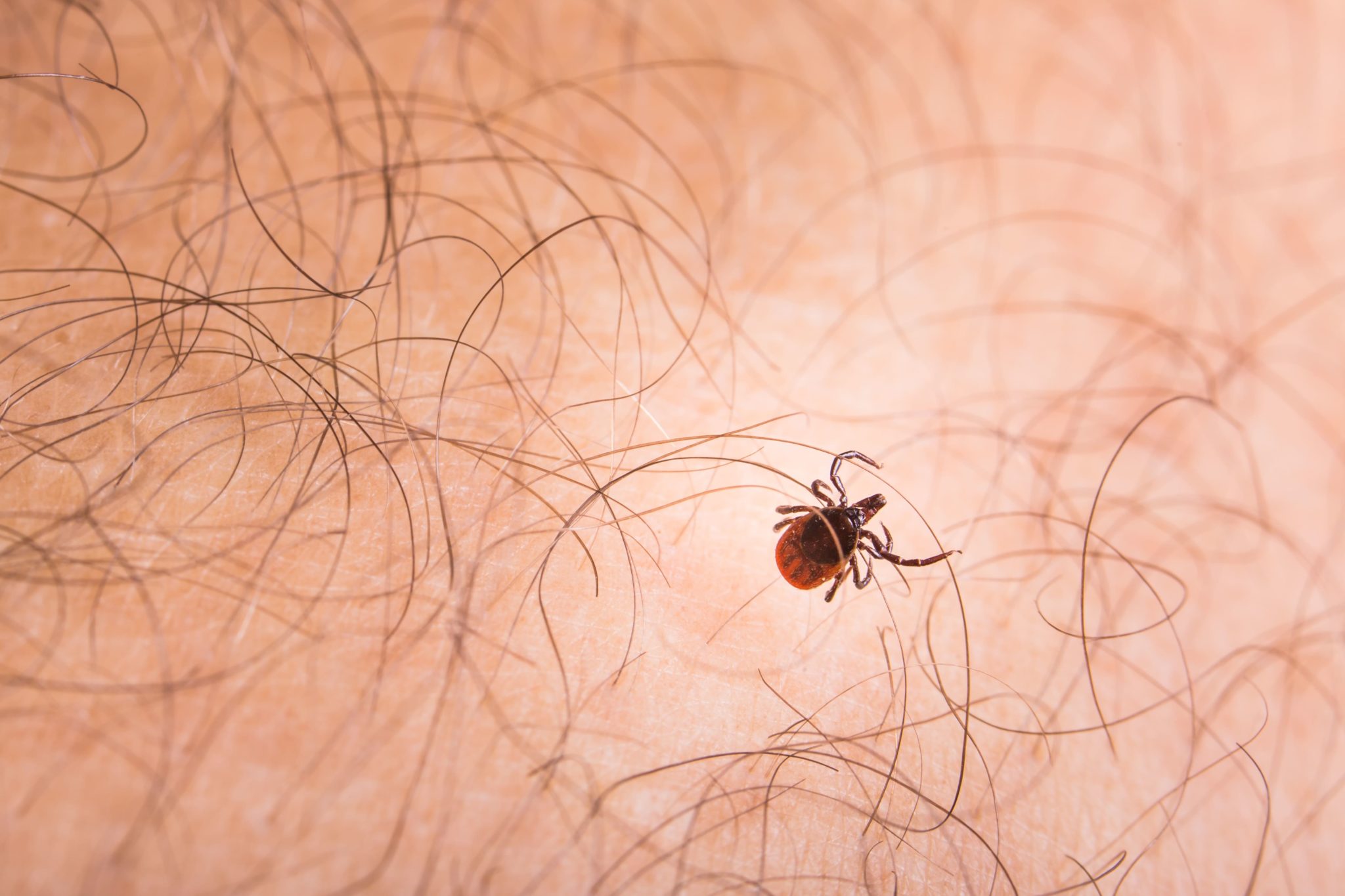 Malattia Di Lyme Come Si Manifesta Diagnosi E Cura